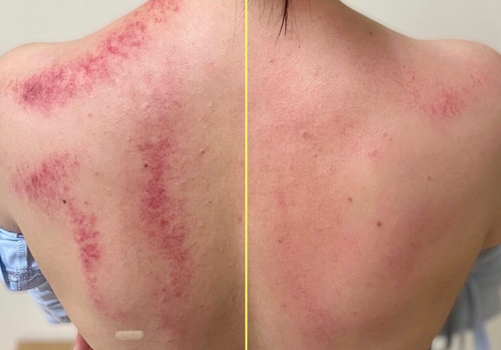 高雄整骨